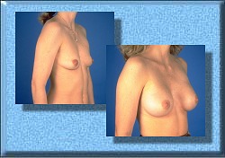 Now I go with bare breast into the office !