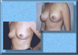 Each man wants to squirt his sperm on them !